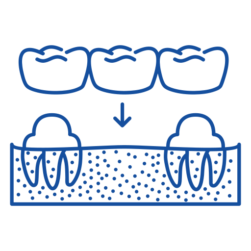 Banner Content Image: https://www.abbeydentalsupplies.com/images/banner/source/denture%20%282%29.tOyA5GsE09.png?t=1712064786