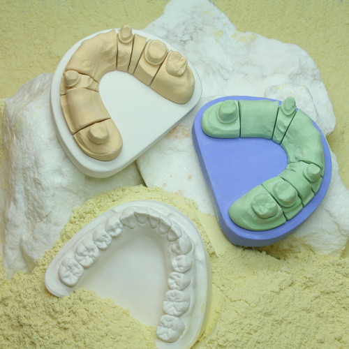 Excalibur White, Die Stone Type 4 (Natural Material) - 25Kg